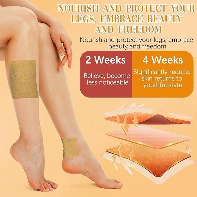 Spider & Varicose Vein Patches | Natural Herbal Therapy for Swelling, Fatigue & Vein Health   (BUY 12 GET 12 FREE)